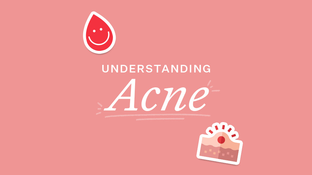 Understanding Acne: Causes, Effects & Solutions