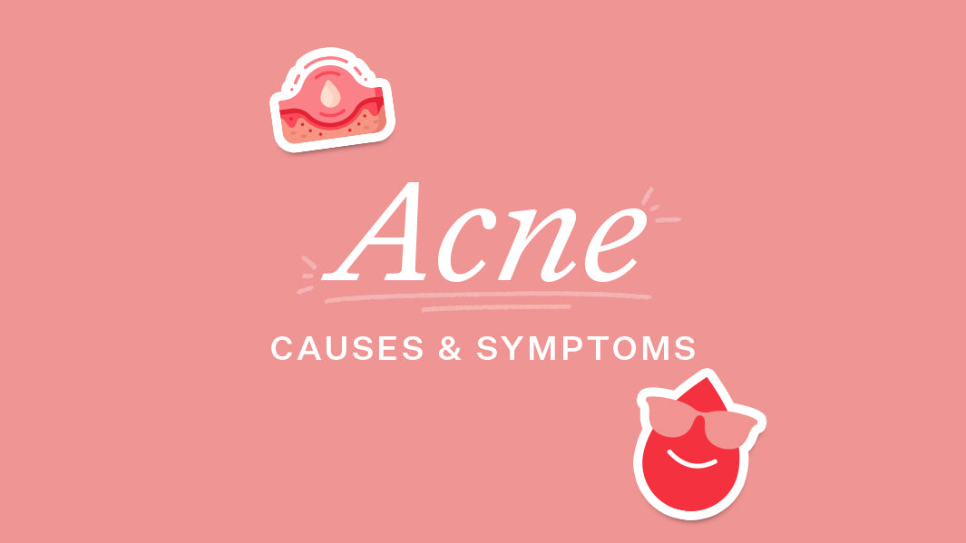 Acne Causes and Symptoms